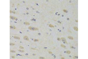 Immunohistochemistry of paraffin-embedded Rat brain using RPL9 Polyclonal Antibody at dilution of 1:100 (40x lens). (RPL9 antibody)