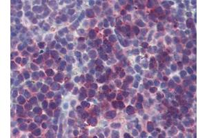 Mouse Spleen (formalin-fixed, paraffin-embedded) stained with TSLPfollowed by biotinylated goat anti-rabbit IgG secondary antibody, alkaline phosphatase-streptavidin and chromogen. (Thymic Stromal Lymphopoietin antibody)
