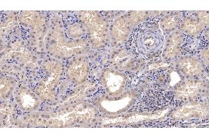 Detection of CD73 in Human Kidney Tissue using Monoclonal Antibody to Cluster Of Differentiation 73 (CD73) (CD73 antibody  (AA 29-500))