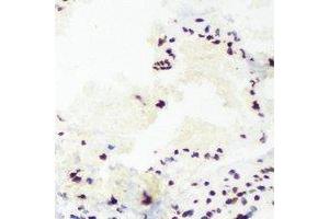 Immunohistochemical analysis of TAFI110 staining in mouse lung formalin fixed paraffin embedded tissue section. (TAF1C antibody)