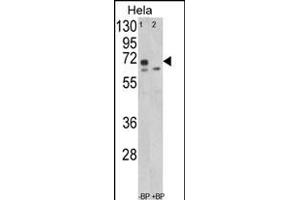 Western blot analysis of LMOD1 Antibody (Center ) (ABIN652551 and ABIN2842369) in Hela cell line lysates (35 μg/lane). (Leiomodin 1 antibody  (AA 214-241))