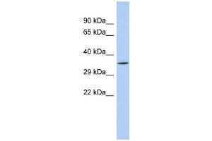 SIRT4 antibody used at 0. (SIRT4 antibody  (N-Term))