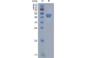 Bone Marrow Stromal Cell Antigen 2 (BST2) protein (Fc Tag)