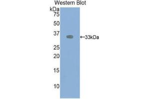 Western Blotting (WB) image for anti-VEGF Receptor 2 (VEGFR2) (AA 46-320) antibody (ABIN1078658) (VEGFR2/CD309 antibody  (AA 46-320))