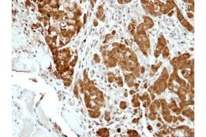 IHC-P Image Immunohistochemical analysis of paraffin-embedded A549 xenograft, using BCL2L15, antibody at 1:500 dilution. (BCL2-Like 15 antibody)