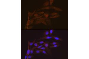 Immunofluorescence analysis of U-2 OS cells using SMC4 Rabbit mAb (ABIN7270618) at dilution of 1:100 (40x lens). (SMC4 antibody)