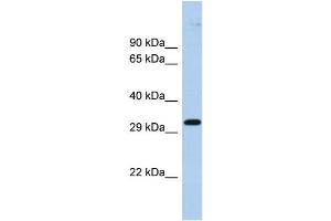 Host:  Rabbit  Target Name:  ZNF397  Sample Type:  Fetal Brain lysates  Antibody Dilution:  1. (ZNF397 antibody  (Middle Region))