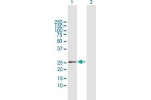 Western Blot analysis of CSN1S1 expression in transfected 293T cell line by CSN1S1 MaxPab polyclonal antibody.