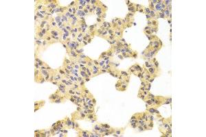 Immunohistochemistry of paraffin-embedded rat lung using MAP2K1 antibody. (MEK1 antibody  (AA 1-100))