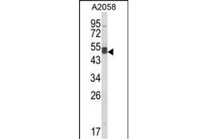Western blot analysis of AGT3 Antibody (Center) (ABIN652630 and ABIN2842420) in  cell line lysates (35 μg/lane).