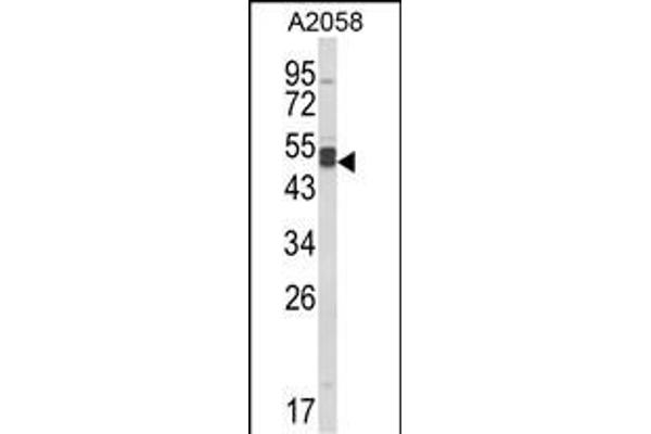 AGPAT3 anticorps  (AA 241-269)