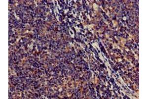 Immunohistochemistry of paraffin-embedded human lymph node tissue using ABIN7170561 at dilution of 1:100 (SAMD8 antibody  (AA 1-152))