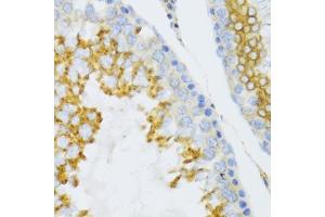 Immunohistochemistry of paraffin-embedded mouse testis using PTN Antibody (ABIN3017413, ABIN3017414, ABIN1682388 and ABIN6220085) at dilution of 1:100 (40x lens). (Pleiotrophin antibody)