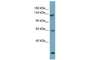 LATS1 antibody used at 1 ug/ml to detect target protein. (LATS1 antibody)