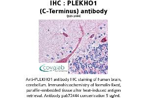 Image no. 1 for anti-Pleckstrin Homology Domain Containing, Family O Member 1 (PLEKHO1) (C-Term) antibody (ABIN1738152)