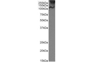Western Blotting (WB) image for anti-Mucin 1 (MUC1) antibody (ABIN5668231)
