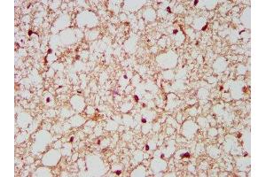 IHC image of ABIN7161257 diluted at 1:500 and staining in paraffin-embedded human brain tissue performed on a Leica BondTM system.