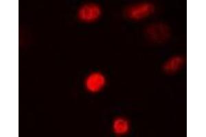 Immunofluorescent analysis of SAMHD1 staining in MCF7 cells. (SAMHD1 antibody)