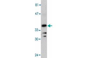 Western blot analysis of MYD88 in Jurkat whole cell lysate with MYD88 polyclonal antibody  at 1 : 500 dilution. (MYD88 antibody  (AA 233-248))
