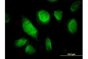 Immunofluorescence of purified MaxPab antibody to RHOQ on HeLa cell.