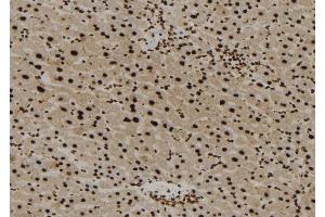 Immunohistochemistry (IHC) image for anti-Apoptosis-Inducing Factor, Mitochondrion-Associated, 1 (AIFM1) (C-Term) antibody (ABIN6259842)