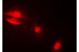 Immunofluorescent analysis of Cytokeratin 14 staining in MCF7 cells. (KRT14 antibody  (N-Term))