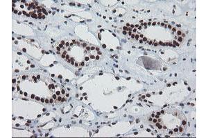 Image no. 4 for anti-TP53RK Binding Protein (TPRKB) antibody (ABIN1501484)