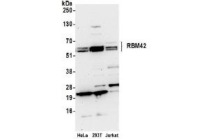 Western Blotting (WB) image for anti-RNA Binding Motif Protein 42 (RBM42) (AA 430-480) antibody (ABIN7450643) (RBM42 antibody  (AA 430-480))