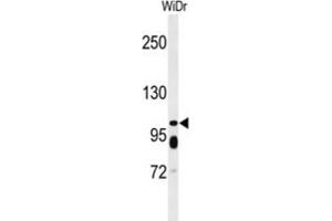 Western Blotting (WB) image for anti-ATP-Binding Cassette, Sub-Family C (CFTR/MRP), Member 11 (ABCC11) antibody (ABIN3002133) (ABCC11 antibody)