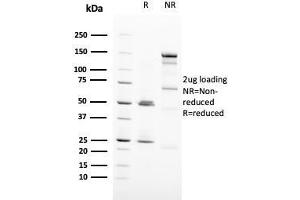 SDS-PAGE Analysis Purified HER-2 Monospecific Mouse Monoclonal Antibody (ERBB2/3093). (ErbB2/Her2 antibody  (AA 311-462))