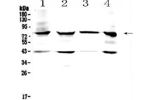 Western blot analysis of HSD17B4 using anti- HSD17B4 antibody . (HSD17B4 antibody  (C-Term))