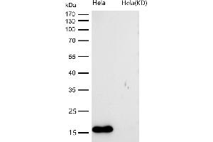 All lanes use the Antibody at 1:1K dilution for 1 hour at room temperature. (Recombinant NUDT1 antibody)