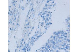 Immunohistochemistry (IHC) image for anti-Nephrosis 1, Congenital, Finnish Type (Nephrin) (NPHS1) antibody (ABIN1873932)