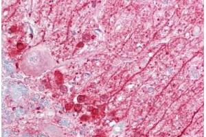 Anti-DBI antibody IHC staining of human brain, cerebellum. (Diazepam Binding Inhibitor antibody  (N-Term))