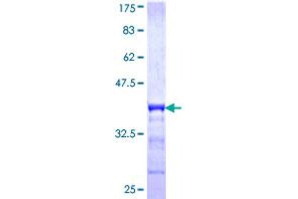Uroplakin 1B Protein (UPK1B) (AA 131-228) (GST tag)