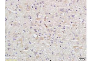 Formalin-fixed and paraffin embedded rat brain labeled with Anti Caspase-9 p10 Polyclonal Antibody, Unconjugated (ABIN1387603) at 1:200 followed by conjugation to the secondary antibody and DAB staining (Caspase 9 antibody  (AA 351-416))