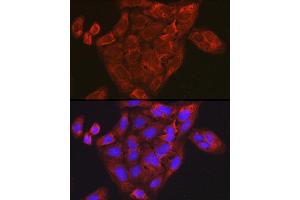 Immunofluorescence analysis of U-2 OS cells using CCL3 Rabbit pAb (ABIN6130184, ABIN6138061, ABIN6138062 and ABIN6223474) at dilution of 1:100 (40x lens). (CCL3 antibody  (AA 24-92))