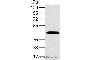 Western blot analysis of A375 cell, using MAGEA10 Polyclonal Antibody at dilution of 1:400 (MAGEA10 antibody)