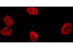 ABIN6276705 staining  Hela cells by IF/ICC. (RENT1/UPF1 antibody)