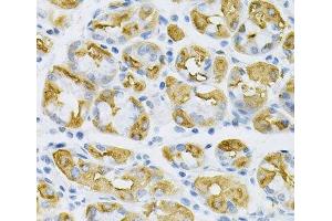 Immunohistochemistry of paraffin-embedded Human stomach using SDC4 Polyclonal Antibody at dilution of 1:100 (40x lens). (SDC4 antibody)