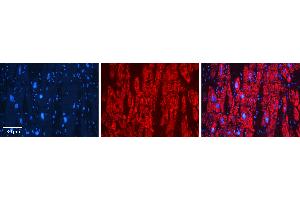 Rabbit Anti-GSTA4 Antibody   Formalin Fixed Paraffin Embedded Tissue: Human heart Tissue Observed Staining: Cytoplasmic Primary Antibody Concentration: N/A Other Working Concentrations: 1:600 Secondary Antibody: Donkey anti-Rabbit-Cy3 Secondary Antibody Concentration: 1:200 Magnification: 20X Exposure Time: 0. (GSTA4 antibody  (C-Term))