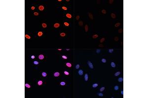 Immunofluorescence (IF) image for anti-Histone H2B (acLys5) antibody (ABIN7267733)