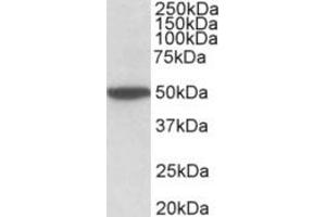 Western Blotting (WB) image for anti-Cholinergic Receptor, Muscarinic 2 (CHRM2) (Internal Region) antibody (ABIN2465137) (Muscarinic Acetylcholine Receptor M2 antibody  (Internal Region))