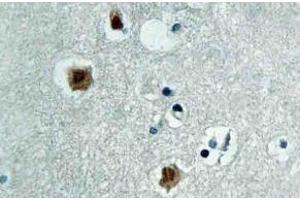 Immunohistochemistry (IHC) analyzes of PAKbeta antibody in paraffin-embedded human brain tissue. (PAK3 antibody)