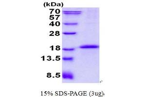 Image no. 1 for CD79b Molecule, Immunoglobulin-Associated beta (CD79B) protein (His tag) (ABIN1098714)