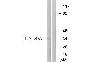 Western blot analysis of extracts from COLO cells, using HLA-DOA antibody. (HLA-DOA antibody  (Internal Region))