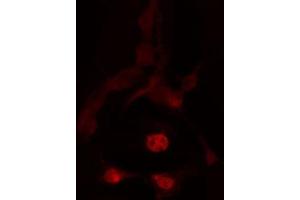 ABIN6272442 staining HeLa by IF/ICC. (TBX2 antibody  (C-Term))