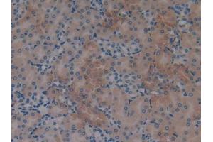 DAB staining on IHC-P; Samples: Mouse Ovary Tissue) (S100A6 antibody  (AA 1-89))