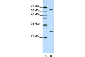 Western Blotting (WB) image for anti-Nudix (Nucleoside Diphosphate Linked Moiety X)-Type Motif 21 (NUDT21) antibody (ABIN2462233) (NUDT21 antibody)