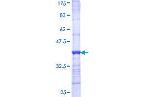 CPS1 Protein (AA 1400-1500) (GST tag)